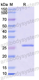 Recombinant Mouse IL34 Protein, N-His