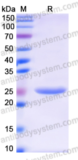 Recombinant Mouse ADAMTS13 Protein, N-His