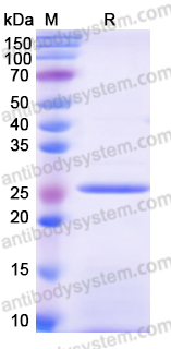 Recombinant Mouse METTL3 Protein, N-His