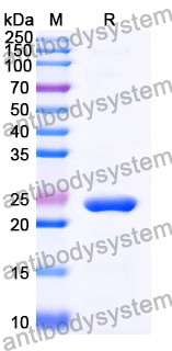 Recombinant Mouse PDPN/Podoplanin Protein, N-His-SUMO