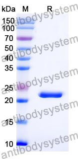 Recombinant Mouse IFNLR1 Protein, N-His
