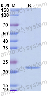 Recombinant Mouse IL28B/IL28C/IFNL3 Protein, N-His