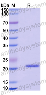 Recombinant Mouse IL28A/IFNL2 Protein, N-His