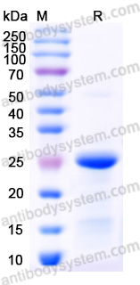Recombinant Mouse IL22RA1 Protein, N-His