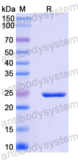 Recombinant Mouse IL31RA Protein, N-His