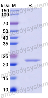 Recombinant Mouse CD200R1/OX2R Protein, N-His