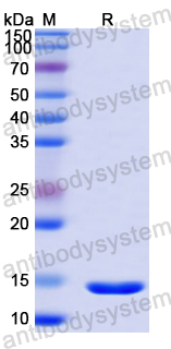 Recombinant Mouse CD366/HAVCR2/TIM-3 Protein, N-His