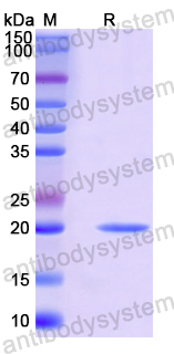 Recombinant Mouse CCL17/TARC Protein, N-His-SUMO