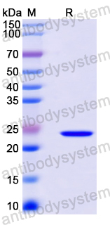 Recombinant Mouse RGMA Protein, N-His
