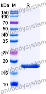 Recombinant Mouse IL17F Protein, N-His