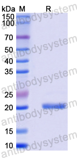 Recombinant Mouse NODAL Protein, N-His