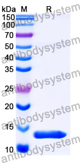Recombinant Mouse ACE2 Protein, N-His