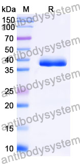 Recombinant Mouse FOXP3 Protein, N-GST & C-His