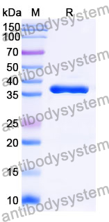 Recombinant Mouse IL1RL2/IL-36R Protein, N-His