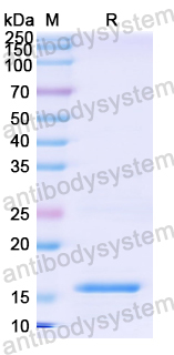 Recombinant Mouse IL21 Protein, N-His