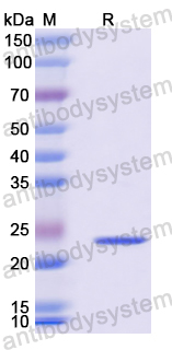 Recombinant Mouse CD229/LY9 Protein, N-His