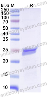 Recombinant Mouse S100A14 Protein, N-His