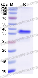 Recombinant Mouse S100A14 Protein, N-GST & C-His