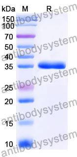 Recombinant Mouse RETN/Resistin Protein, N-GST & C-His
