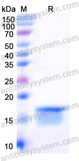 Recombinant Mouse CD354/TREM1 Protein, N-His