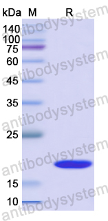 Recombinant Mouse ESM1 Protein, N-His