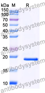 Recombinant Mouse DLL4 Protein, N-His