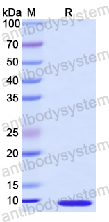 Recombinant Mouse CCL28/MEC Protein, N-His