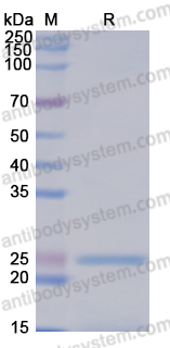 Recombinant Mouse FGF21 Protein, N-His