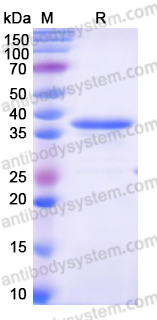 Recombinant Mouse IRAK4 Protein, N-His