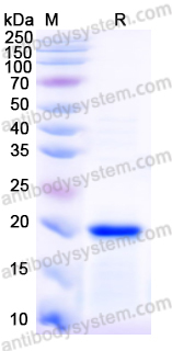 Recombinant Mouse IL36RN/IL-1F5/IL-36Ra Protein, N-His