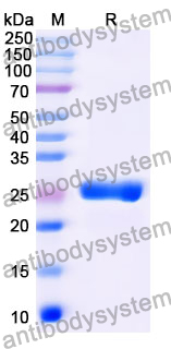 Recombinant Mouse CTSZ Protein, N-His