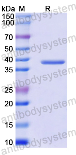 Recombinant Mouse MARCO Protein, N-GST & C-His