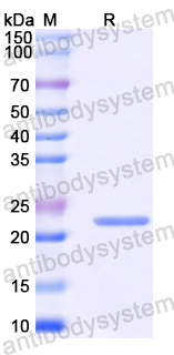 Recombinant Mouse CD84 Protein, N-His