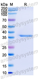 Recombinant Mouse COL17A1/Bp180 Protein, N-GST & C-His