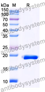 Recombinant Mouse CD201/PROCR/EPCR Protein, N-His