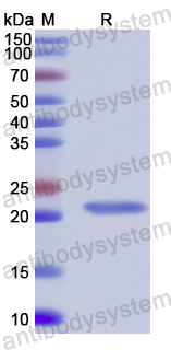 Recombinant Mouse RIMS2 Protein, N-His