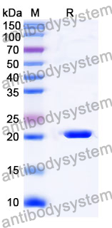 Recombinant Mouse JAG2 Protein, N-His