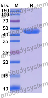 Recombinant Mouse Cd209a Protein, N-GST & C-His