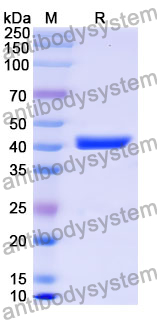 Recombinant Mouse CD370/CLEC9A Protein, N-GST & C-His