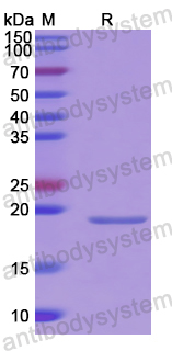 Recombinant Mouse RNF168 Protein, N-His