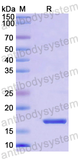 Recombinant Mouse PDGFD Protein, N-His