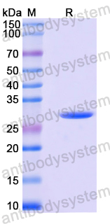 Recombinant Mouse LOXL2 Protein, N-His