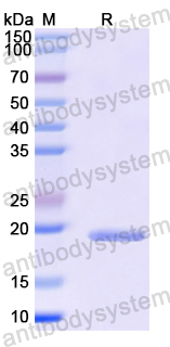 Recombinant Mouse VSIR/VISTA Protein, N-His