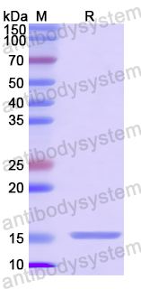 Recombinant Mouse EHF/ESE-3 Protein, C-His