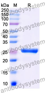 Recombinant Mouse SIGLEC15 Protein, N-His