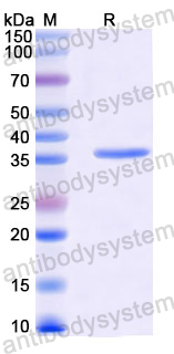 Recombinant Mouse TENT4A/PAPD7/TRF4 Protein, N-His