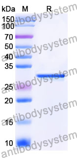 Recombinant Mouse SPHK2 Protein, N-His