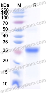 Recombinant Mouse KLK5 Protein, N-His