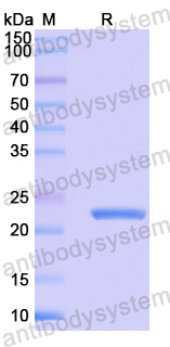 Recombinant Mouse ERAP1 Protein, N-His