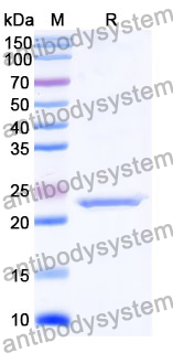 Recombinant Mouse ULBP1 Protein, N-His